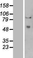 PLAT / TPA Protein (Over-Expression Lysate Myc-DDK (Flag))