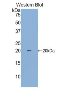 MUC4 Antibody (aa1154-1309, PE)