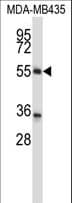 ZNF222 Antibody (aa1-30)