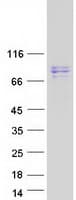Human SUPV3L1 Protein (Recombinant Myc-DDK (Flag))