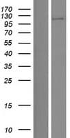 BBX Protein (Over-Expression Lysate Myc-DDK (Flag))