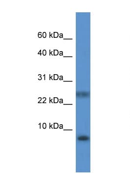 Polyclonal Rabbit anti-Human PRAC1 / PRAC Antibody (C-Terminus, WB)