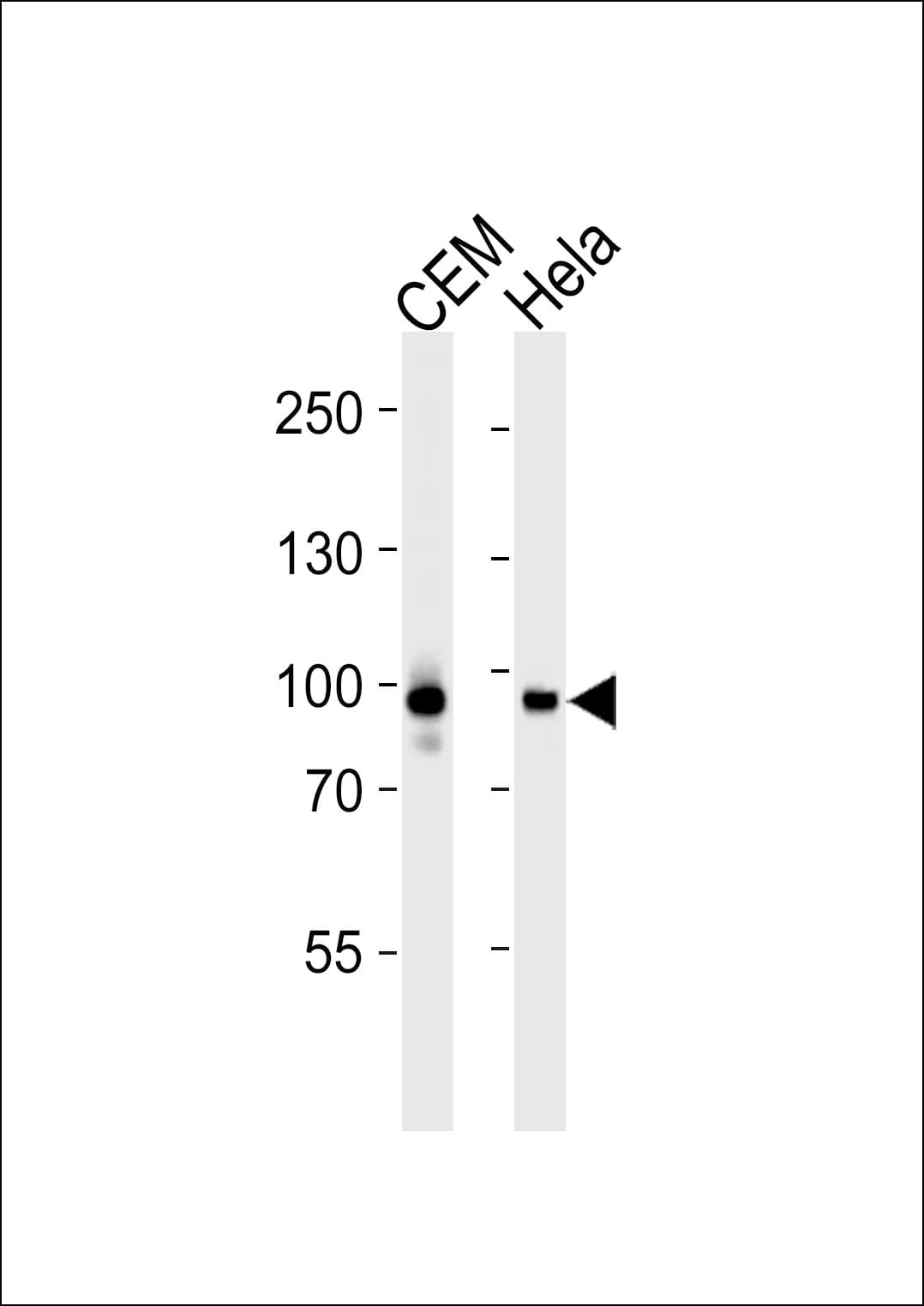 STAT3 Antibody (clone 1200CT146.104.153)