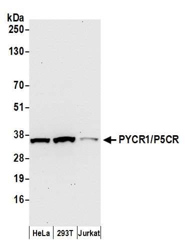 PYCR1 Antibody (aa269-319)