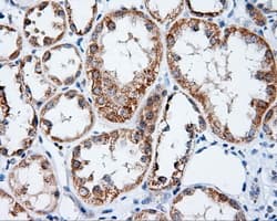 APP / Beta Amyloid Precursor Antibody (clone OTI5C5)