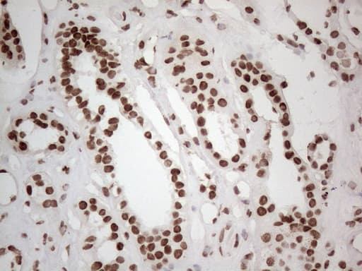 Monoclonal Mouse anti-Human HNRNPL / hnRNP L Antibody (clone OTI4E5, aa270-502, IHC)