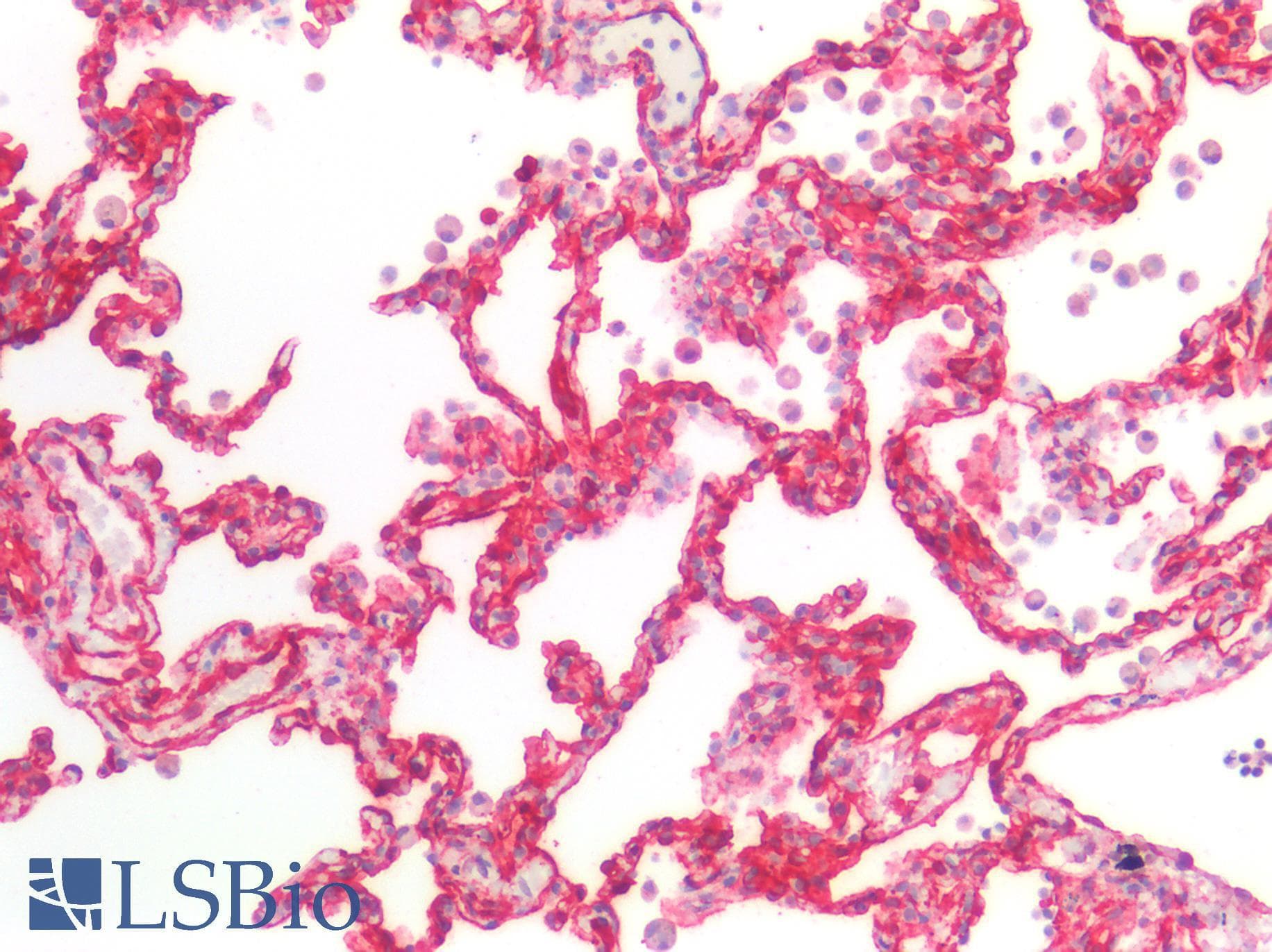 IHC-plus™ CAV1 / Caveolin 1 Antibody (aa129-178)