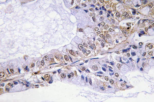 CFL1 / Cofilin Antibody (phospho-Ser3)