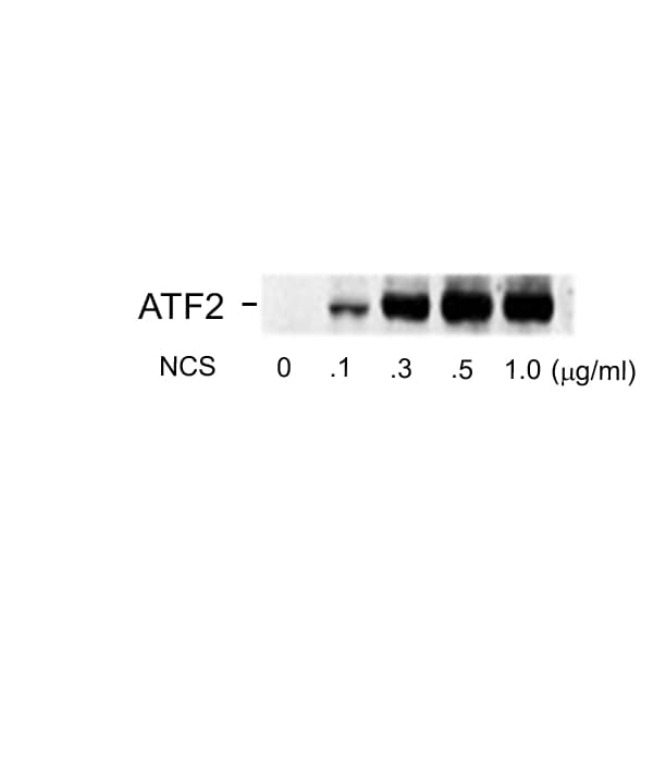 ATF2 Antibody (phospho-Ser490/Ser498)