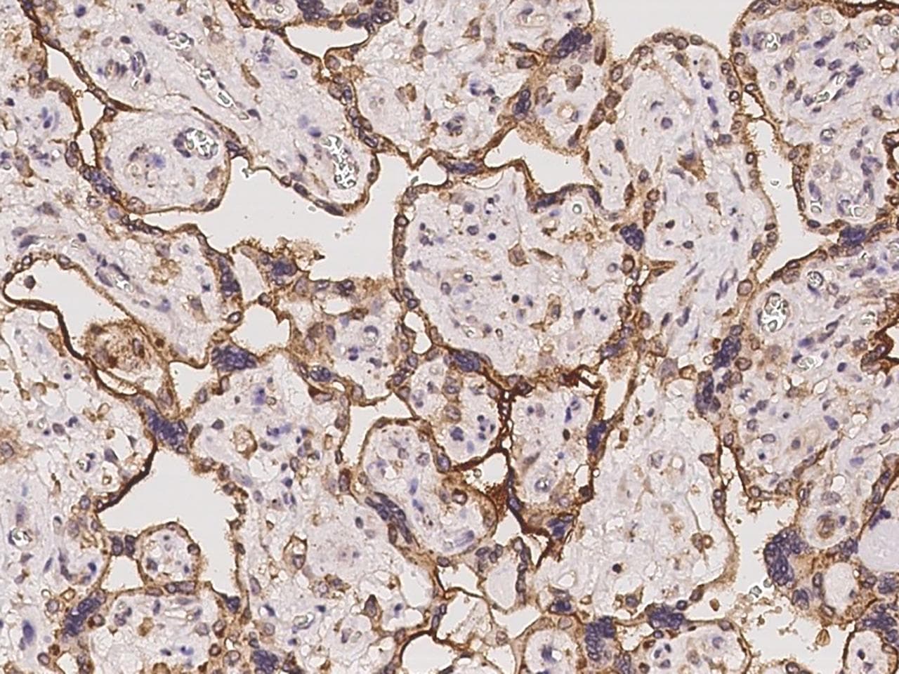 MYD118 / GADD45B Antibody
