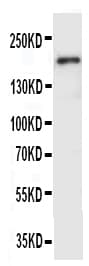 KDR / VEGFR2 / FLK1 Antibody (aa454-469)