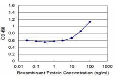 TPTE Antibody (clone 1F8)