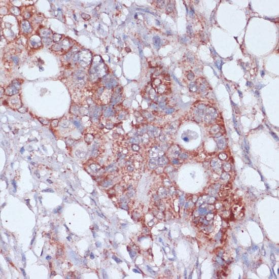 MRPL23 Antibody