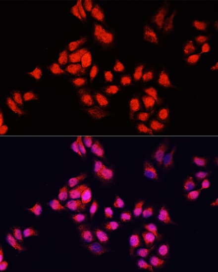 BRCA1 Antibody