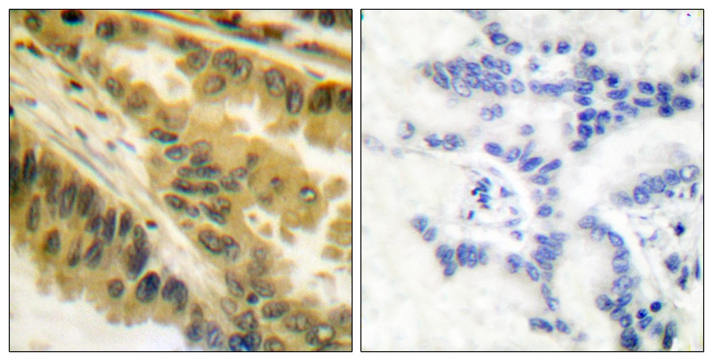 PRKCZ / PKC-Zeta Antibody (p410)