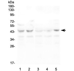 CCR10 / GPR2 Antibody
