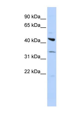 ADRB2 Antibody (C-Terminus)