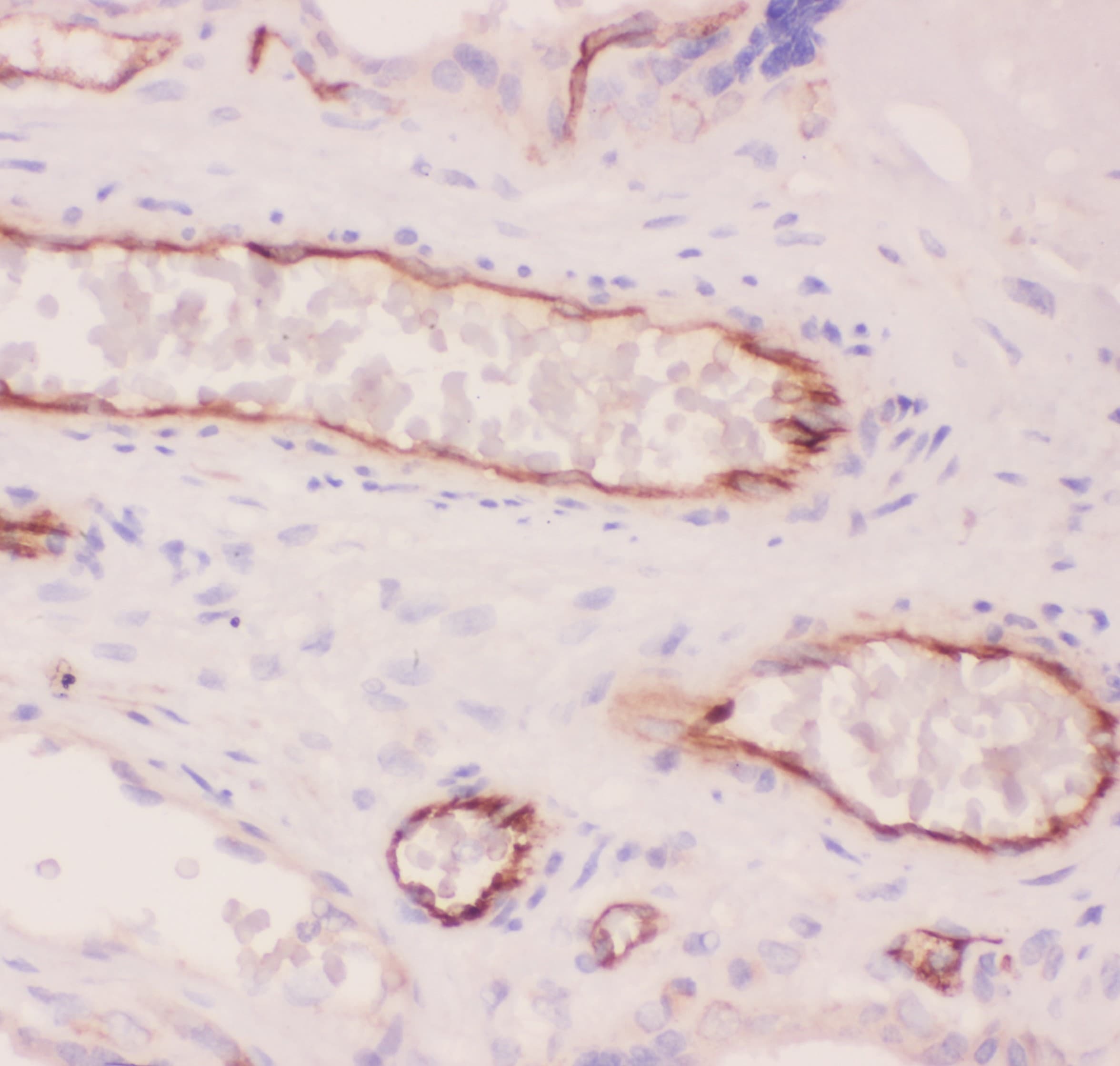 ACE / CD143 Antibody (aa651-864)