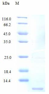 Human CX3CL1 / Fractalkine Protein (Recombinant)