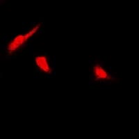 Polyclonal Rabbit anti-Human PSMB4 Antibody (IF, WB)