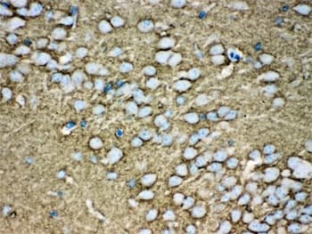 Polyclonal Rabbit anti-Human STXBP1 / MUNC18-1 Antibody (IHC, WB)