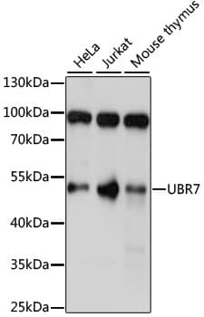 Polyclonal Rabbit anti-Human UBR7 / C14orf130 Antibody (WB)