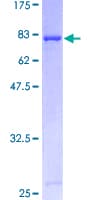 Human TP53 / p53 Protein (Recombinant GST)