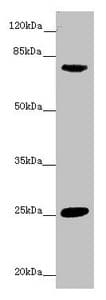 Polyclonal Rabbit anti-Human CACNB1 Antibody (IHC, WB)