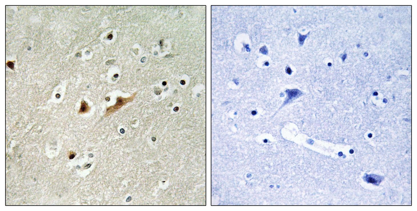 RACGAP1 / MGCRACGAP Antibody
