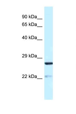 YIPF5 Antibody (aa54-103)