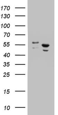 DDX6 Antibody (aa1-298, clone OTI3B7, Carrier-free)