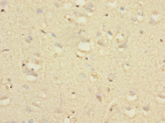Polyclonal Rabbit anti-Human NTM / Neurotrimin Antibody (IHC, WB)