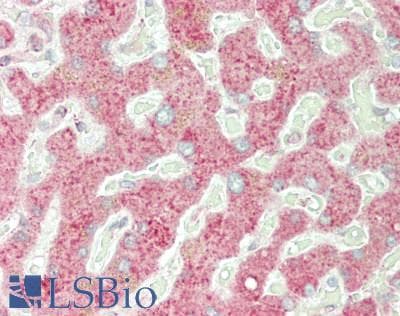 IHC-plus™ Monoclonal Mouse anti-Human TS / Thymidylate Synthase Antibody (clone 10F12, IHC, WB)