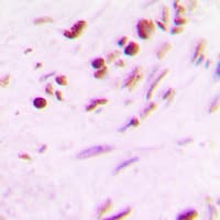 MYF5 / MYF 5 Antibody (Internal)