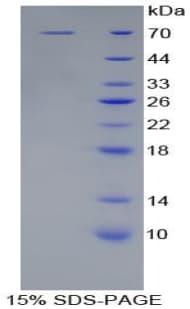 Human KIR2DL2 / CD158b Protein (Recombinant His-GST)
