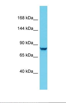 Polyclonal Rabbit anti-Human DENND4C Antibody (aa536-585, WB)