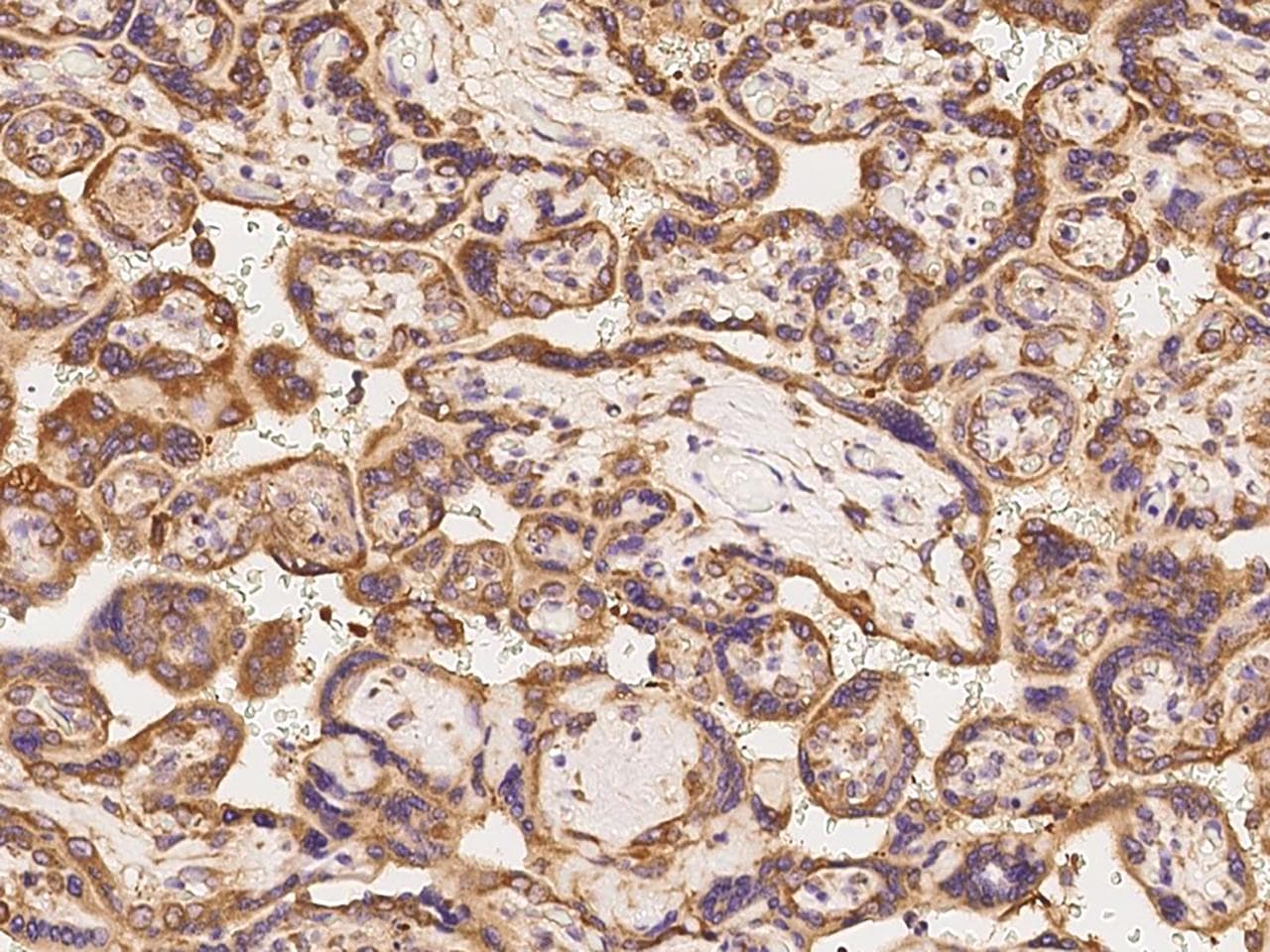 Polyclonal Rabbit anti-Human EIF3M / PCID1 Antibody (IHC)