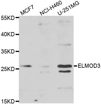 Polyclonal Rabbit anti-Human ELMOD3 Antibody (WB)