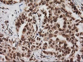 LOX / Lysyl Oxidase Antibody (clone OTI9G2)