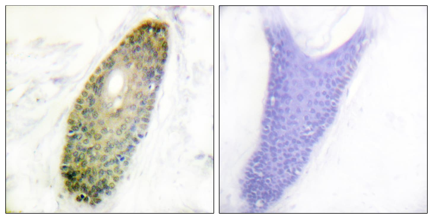 HDAC3 Antibody (phospho-Ser424)