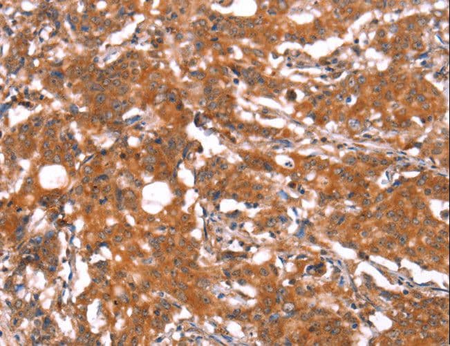 FUT1 / HSC Antibody