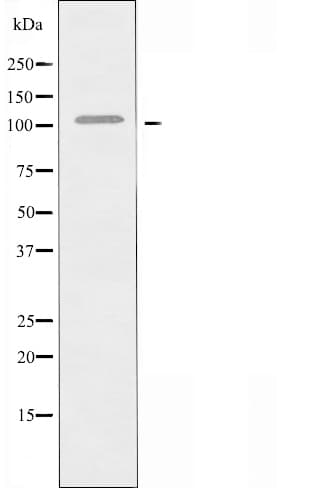 Polyclonal Rabbit anti-Human FCRL5 / CD307 Antibody (IF, WB)