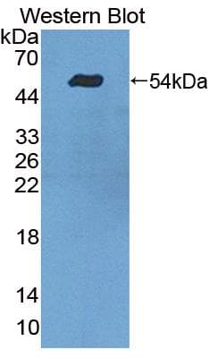 TDP1 Antibody