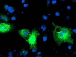 PDIA4 / ERP72 Antibody (clone OTI2E11)