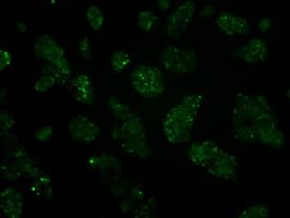 IFT57 / HIPPI Antibody (clone OTI2G3)