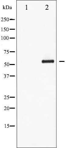 MEF2A / MEF2 Antibody (phospho-Thr312)
