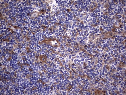 LGALS3 / Galectin 3 Antibody (clone OTI1C7)
