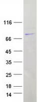 Human LRRC40 Protein (Recombinant Myc-DDK (Flag))