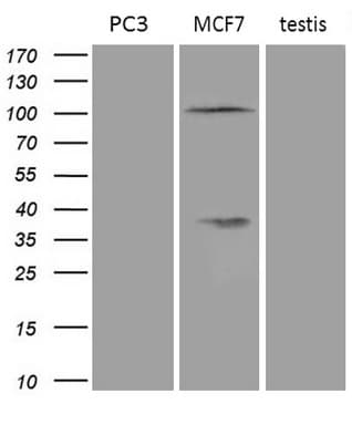 Monoclonal Mouse anti-Human AR / Androgen Receptor Antibody (clone OTI3C5, Carrier-free, aa420-659, IHC, WB)