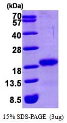 Human GABARAP Protein (Recombinant His)